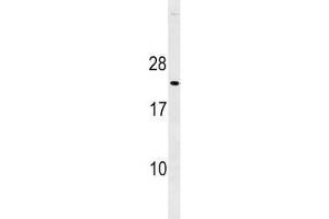 Western Blotting (WB) image for anti-Cyclin-Dependent Kinase Inhibitor 1B (p27, Kip1) (CDKN1B) (AA 175-197) antibody (ABIN3030625)