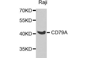 Western blot analysis of extracts of various cell lines, using CD79A antibody. (CD79a antibody  (AA 33-145))