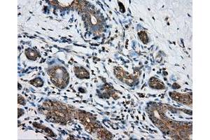 Immunohistochemical staining of paraffin-embedded breast tissue using anti-PRKAR2A mouse monoclonal antibody.