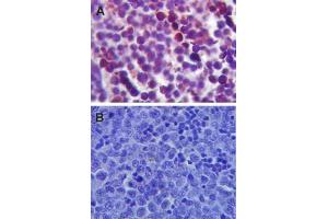 Image no. 2 for anti-Toll-Like Receptor 4 (TLR4) (AA 420-435) antibody (ABIN361724) (TLR4 antibody  (AA 420-435))
