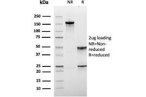 SDS-PAGE Analysis Purified Monospecific Mouse Monoclonal Antibody to LAG-3 (LAG3/3261). (LAG3 antibody)