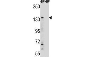 Western blot analysis of JMJD3 antibody and HeLa lysate (Kdm6b antibody  (AA 954-987))