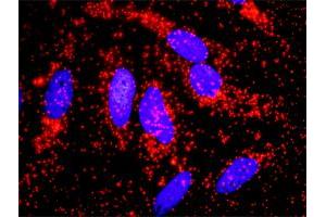 Proximity Ligation Analysis of protein-protein interactions between ACTN4 and CTNNB1. (alpha Actinin 4 antibody  (AA 1-911))