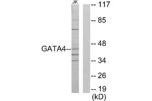 Western blot analysis of extracts from Jurkat cells, using GATA4 antibody. (GATA4 antibody  (Internal Region))