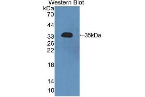 Western blot analysis of the recombinant protein. (SGK2 antibody  (AA 40-311))