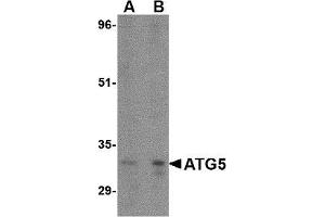 Western blot. (ATG5 antibody  (N-Term))