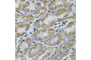 Immunohistochemistry of paraffin-embedded human stomach using PTK7 antibody. (PTK7 antibody)