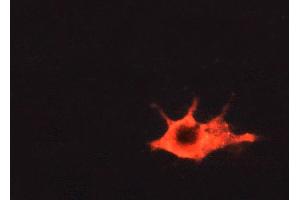 immunofluorescence analysis of A549 cells, using 1/500-1/1000 (BMX antibody  (C-Term))