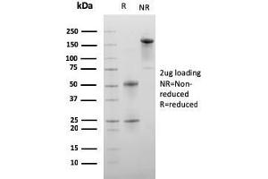 SDS-PAGE Analysis Purified C1QA Mouse Monoclonal Antibody (C1QA/2956).