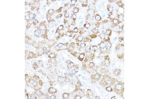 Immunohistochemistry of paraffin-embedded human liver using Kaiso/Kaiso/ZBTB33 Rabbit pAb  at dilution of 1:350 (40x lens). (ZBTB33 antibody  (AA 523-672))