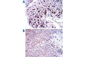 Immunohistochemical analysis of paraffin-embedded human testis (A) and human ovarian cancer (B) tissues using NQO1 monoclonal antibody, clone 4D12  with DAB staining.