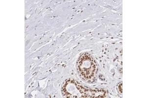 Immunohistochemical staining of human breast with ZNF275 polyclonal antibody  shows strong nuclear positivity in glandular cells. (ZNF275 antibody)