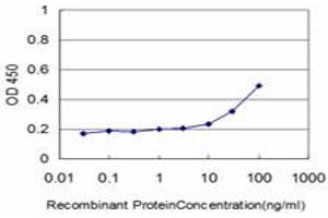 Detection limit for recombinant GST tagged DLD is approximately 1ng/ml as a capture antibody. (DLD antibody  (AA 1-509))