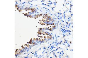 Immunohistochemistry of paraffin-embedded mouse lung using TMED3 antibody (ABIN7270944) at dilution of 1:100 (40x lens). (TMED3 antibody  (AA 24-180))