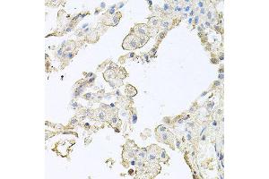 Immunohistochemistry of paraffin-embedded human lung using MMRN1 antibody at dilution of 1:100 (x40 lens). (Multimerin 1 antibody)