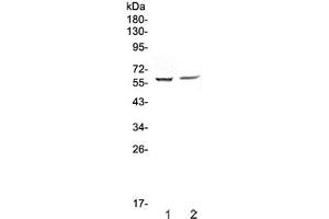 Western blot testing of human 1) HepG2 and 2) PANC-1 cell lysate with STAM1 antibody at 0. (STAM antibody)