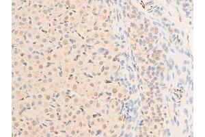 Immunohistochemistry (IHC) image for anti-serum/glucocorticoid Regulated Kinase 1 (SGK1) (pSer422) antibody (ABIN6256329)