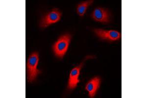 Immunofluorescent analysis of Cytokeratin 18 staining in MCF7 cells.