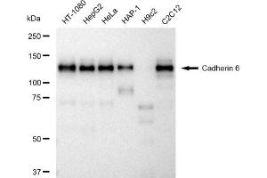 Western blotting analysis using Cadherin 6 antibody (ABIN7799153).
