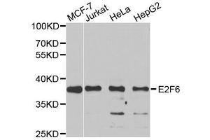 Western blot analysis of extracts of various cell lines, using E2F6 antibody (ABIN5973627) at 1/1000 dilution.