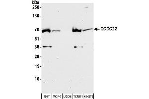Western Blotting (WB) image for anti-Coiled-Coil Domain Containing 22 (CCDC22) (AA 577-627) antibody (ABIN7452809)