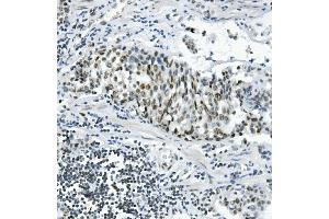 IHC analysis of PRDM5 using anti-PRDM5 antibody (ABIN7600853).