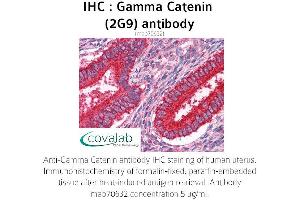 Image no. 2 for anti-Junction Plakoglobin (JUP) (AA 1-746), (full length) antibody (ABIN1723489) (JUP antibody  (full length))