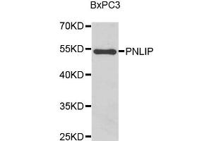 Western blot analysis of BxPC3 cell lysate using PNLIP antibody. (PNLIP antibody)