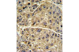 Immunohistochemistry (IHC) image for anti-Collagen, Type VI, alpha 1 (COL6A1) antibody (ABIN3002699) (COL6A1 antibody)
