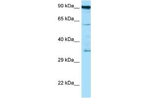Western Blotting (WB) image for anti-CD82 (CD82) (C-Term) antibody (ABIN2789464) (CD82 antibody  (C-Term))