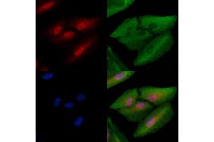 ABIN6261798 and ABIN6278670 staining  cells by IF/ICC.
