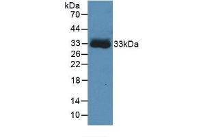 Western blot analysis of the recombinant protein. (Hemoglobin Subunit beta antibody)