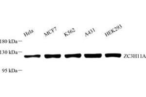 Western blot analysis of ZC3H11A (ABIN7076255) at dilution of 1: 1000