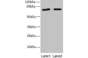 Western blot All lanes: KLHL22 antibody at 8 μg/mL Lane 1: Jurkat whole cell lysate Lane 2: NIH/3T3 whole cell lysate Secondary Goat polyclonal to rabbit IgG at 1/10000 dilution Predicted band size: 72, 56 kDa Observed band size: 72 kDa (KLHL22 antibody  (AA 2-300))