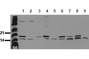 Western Blotting (WB) image for anti-Microtubule-Associated Protein 1 Light Chain 3 beta (MAP1LC3B) (N-Term) antibody (ABIN492615) (LC3B antibody  (N-Term))