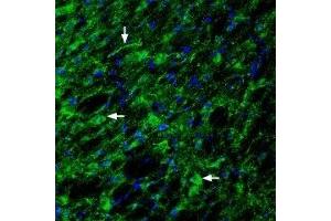 Expression of Glucagon-like peptide 1 receptor in rat hypothalamus - Immunohistochemical staining of rat hypothalamus with Anti-GLP1R (extracellular) Antibody (ABIN7043219, ABIN7044406 and ABIN7044407), (1:200). (GLP1R antibody  (Extracellular))