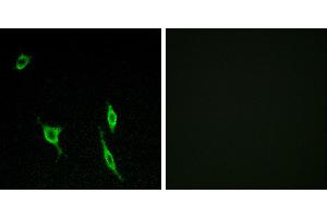 Peptide - +Immunofluorescence analysis of LOVO cells, using DCC antibody. (DCC antibody)