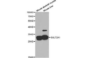 Western blot analysis of extracts of various cell lines, using SULT2A1 antibody (ABIN5973199) at 1/1000 dilution. (SULT2A1 antibody)