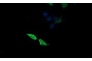 Image no. 5 for anti-Mitogen-Activated Protein Kinase Kinase 3 (MAP2K3) antibody (ABIN1499407) (MAP2K3 antibody)
