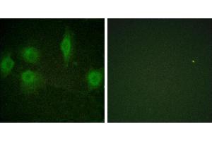 P-peptide - +Immunofluorescence analysis of HuvEc cells, using IL-9R (Phospho-Ser519) antibody. (IL9 Receptor antibody  (pSer519))
