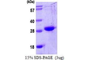 Oncostatin M (OSM) (AA 26-234) protein (His tag)