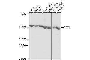 Western blot analysis of extracts of various cell lines, using EIF2S3 antibody (ABIN6130363, ABIN6140051, ABIN6140052 and ABIN6222259) at 1:1000 dilution.