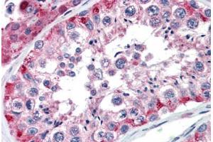 Human Testis (formalin-fixed, paraffin-embedded) stained with NAB1 antibody ABIN462173 followed by biotinylated goat anti-rabbit IgG secondary antibody ABIN481713, alkaline phosphatase-streptavidin and chromogen.