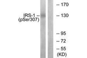 Western blot analysis of extracts from K562 cells, using IRS-1 (Phospho-Ser307) Antibody.