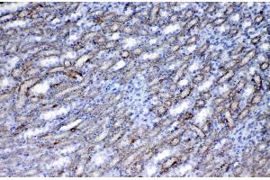 IHC analysis of Flt3 / CD135 using anti-Flt3 / CD135 antibody . (FLT3 antibody  (AA 62-295))