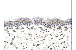 Immunohistochemistry (IHC) image for anti-Formiminotransferase Cyclodeaminase (FTCD) (N-Term) antibody (ABIN2776887) (FTCD antibody  (N-Term))