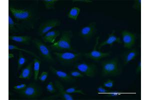 Immunofluorescence of monoclonal antibody to PDCL3 on HeLa cell.
