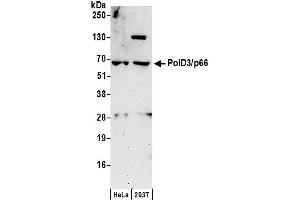 anti-Polymerase (DNA-Directed), delta 3, Accessory Subunit (POLD3) (AA 416-466) antibody