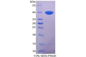 SDS-PAGE analysis of Human Keratin 5 Protein. (Cytokeratin 5 Protein)