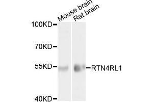Western blot analysis of extracts of mouse brain and rat brain cells, using RTN4RL1 antibody.